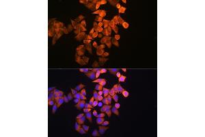 Immunofluorescence analysis of HeLa cells using RRM1 Rabbit pAb (ABIN3021562, ABIN3021563, ABIN3021564 and ABIN6215245) at dilution of 1:100 (40x lens). (RRM1 antibody  (AA 593-792))