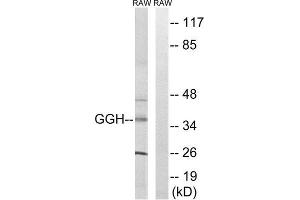 Western Blotting (WB) image for anti-gamma-Glutamyl Hydrolase (Conjugase, Folylpolygammaglutamyl Hydrolase) (GGH) (C-Term) antibody (ABIN1851354) (GGH antibody  (C-Term))