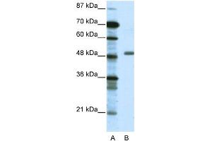 WB Suggested Anti-TADA3L Antibody Titration: 0. (TADA3L antibody  (Middle Region))