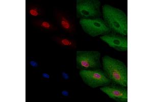 ABIN6257677 and ABIN6275738 staining  cells by IF/ICC.