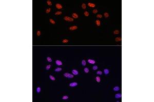 Immunofluorescence analysis of U2OS cells using Phospho-Smad2-S465/467 + Smad3-S423/425 antibody (ABIN6135314, ABIN6136248, ABIN6136249 and ABIN6225575) at dilution of 1:100. (SMAD2 / SMAD3 (pSer423), (pSer425) antibody)
