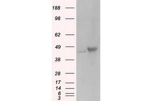 Image no. 1 for anti-Protein Kinase, CAMP-Dependent, Regulatory, Type II, alpha (PRKAR2A) antibody (ABIN1500257) (PRKAR2A antibody)