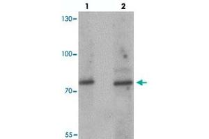 Western blot analysis of JAKMIP1 in rat brain tissue with JAKMIP1 polyclonal antibody  at (lane 1) 1 and (lane 2) 2 ug/mL.