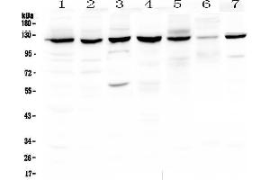 Western blot analysis of PARP using anti-PARP antibody . (PARP1 antibody  (AA 670-858))