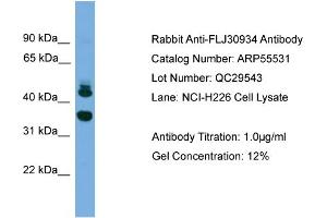 WB Suggested Anti-FLJ30934  Antibody Titration: 0. (FLJ30934 (Middle Region) antibody)