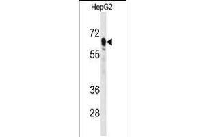 Western blot analysis of anti-PCK2 Antibody in HepG2 cell line lysates (35ug/lane) (PEPCK antibody  (N-Term))