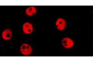 ABIN6278639 staining Hela by IF/ICC. (TAL1 antibody  (C-Term))