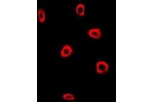 Immunofluorescent analysis of Frataxin staining in MCF7 cells. (Frataxin antibody)