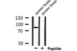 Western blot analysis of extracts from mouse brain, using TMC7 Antibody. (TMC7 antibody  (C-Term))