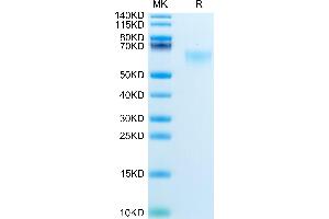 Mouse MADCAM1 on Tris-Bis PAGE under reduced condition. (MADCAM1 Protein (AA 22-364) (His tag))