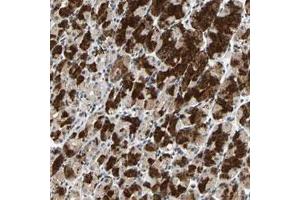 Immunohistochemical staining (Formalin-fixed paraffin-embedded sections) of human stomach with PML polyclonal antibody  shows strong cytoplasmic positivity in glandular cells.