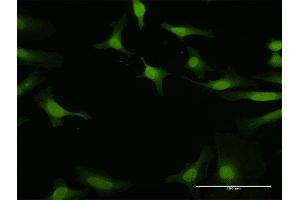 Immunofluorescence of purified MaxPab antibody to IRF5 on HeLa cell. (IRF5 antibody  (AA 1-498))