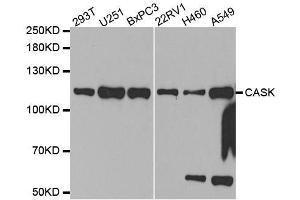 Western blot analysis of extracts of various cell lines, using CASK antibody. (CASK antibody  (AA 1-300))
