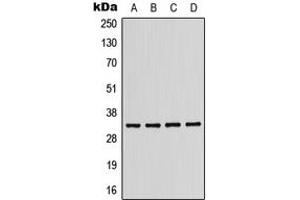 Western blot analysis of CD158b1 expression in MDAMB231 (A), Jurkat (B), mouse liver (C), H9C2 (D) whole cell lysates. (KIR2DL2 antibody  (Center))
