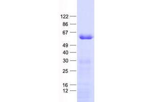Validation with Western Blot (IP6K2 Protein (His tag))