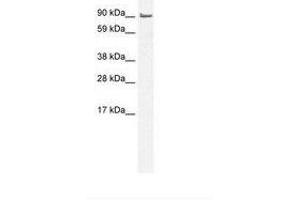 Image no. 1 for anti-LIM Domain and Actin Binding 1 (LIMA1) (AA 502-551) antibody (ABIN6735989) (LIMA1 antibody  (AA 502-551))