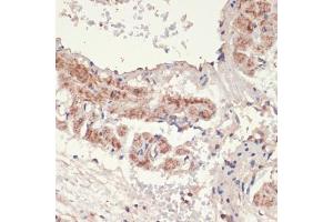 Immunohistochemistry of paraffin-embedded rat lung using A antibody (ABIN1678588, ABIN3015506, ABIN3015508 and ABIN6218562) at dilution of 1:100 (40x lens).