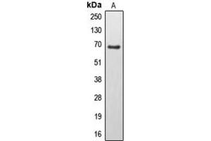 Western blot analysis of EPS8L3 expression in U251MG (A) whole cell lysates. (EPS8-Like 3 antibody  (Center))
