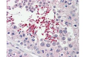 Image no. 1 for anti-ATP-Binding Cassette, Sub-Family D (ALD), Member 2 (Abcd2) (AA 338-558) antibody (ABIN467567) (Abcd2 antibody  (AA 338-558))