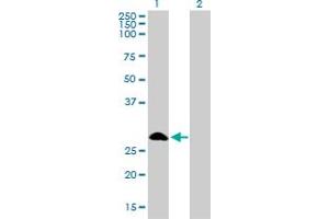 Western Blot analysis of FHL1 expression in transfected 293T cell line by FHL1 monoclonal antibody (M01), clone 2A9.