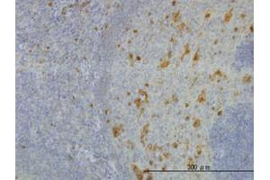 Image no. 4 for anti-Aldo-Keto Reductase Family 1, Member A1 (Aldehyde Reductase) (AKR1A1) (AA 1-326) antibody (ABIN599129) (AKR1A1 antibody  (AA 1-326))