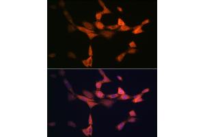Immunofluorescence analysis of NIH-3T3 cells using PIK3R4/VPS15 Rabbit mAb (ABIN7269322) at dilution of 1:100 (40x lens). (PIK3R4 antibody)