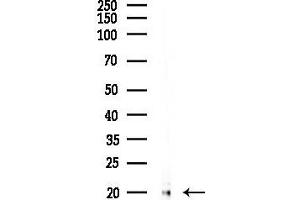 anti-Translocase of Inner Mitochondrial Membrane 17 Homolog A (TIMM17A) (C-Term) antibody