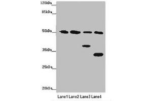 Western blot All lanes: B7H6 antibody at 2 μg/mL Lane 1: Mouse heart tissue Lane 2: Mouse liver tissue Lane 3: Mouse brain tissue Lane 4: Hela whole cell lysate Secondary Goat polyclonal to rabbit IgG at 1/10000 dilution Predicted band size: 51 kDa Observed band size: 51, 38, 32 kDa (B7-H6 antibody  (AA 25-262))