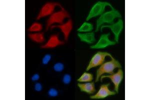 ABIN6263354 and ABIN6278592 staining Hela cells by IF/ICC.