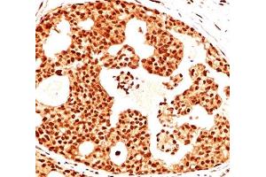 ESR2 antibody  (C-Term)