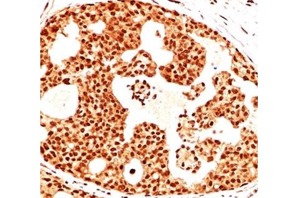 ESR2 antibody  (C-Term)