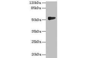 Western blot All lanes: GTDC1 antibody at 4 μg/mL + A549 whole cell lysate Secondary Goat polyclonal to rabbit IgG at 1/10000 dilution Predicted band size: 53, 44, 34, 50, 38 kDa Observed band size: 53 kDa (GTDC1 antibody  (AA 1-292))