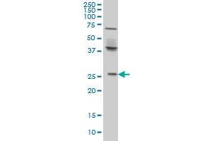 Western Blotting (WB) image for anti-PRELI Domain Containing 1 (PRELID1) (AA 3-101) antibody (ABIN599217)