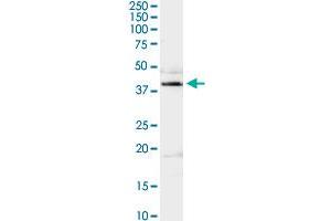 ADA MaxPab rabbit polyclonal antibody. (ADA antibody  (AA 1-363))