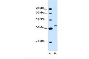 Image no. 1 for anti-Ring Finger Protein 146 (RNF146) (C-Term) antibody (ABIN320783) (RNF146 antibody  (C-Term))