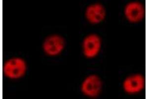 Immunofluorescence (fixed cells) (IF/ICC) image for anti-Nuclear Factor-kB p65 (NFkBP65) (C-Term) antibody (ABIN6263618)