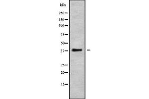 Western blot analysis of APOL6 using COLO205 whole cell lysates (APOL6 antibody  (N-Term))