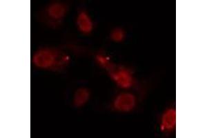 ABIN6275327 staining  MCF7 cells by IF/ICC. (NOC2L antibody  (C-Term))