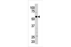 Western blot analysis of anti-GUCY1A3 Pab (ABIN391201 and ABIN2841286) in mouse brain tissue lysate (35 μg/lane). (GUCY1A1 antibody  (N-Term))