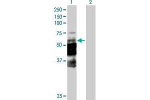 Western Blot analysis of DCP1A expression in transfected 293T cell line by DCP1A MaxPab polyclonal antibody. (DCP1A antibody  (AA 1-582))
