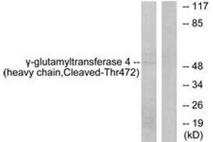 Western blot analysis of extracts from Jurkat cells, treated with etoposide 25uM 24h, using Gamma-glutamyltransferase 4 (heavy chain,Cleaved-Thr472) Antibody. (GGT7 antibody  (Cleaved-Thr472))