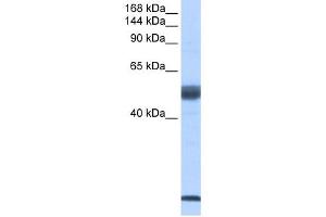WB Suggested Anti-SF3B14 Antibody Titration:  0. (Pre-mRNA Branch Site Protein p14 (SF3B14) (Middle Region) antibody)