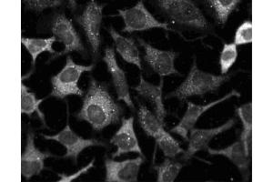 Immunofluorescent staining of HeLa cells (ATCC CCL-2). (MEK1 antibody)