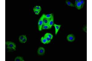 Immunofluorescence staining of HepG2 cells with ABIN7159209 at 1:66, counter-stained with DAPI. (MC3R antibody  (AA 38-74))
