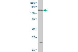 ABL2 monoclonal antibody (M09), clone 5C6 Western Blot analysis of ABL2 expression in K-562 . (ABL2 antibody  (AA 743-842))