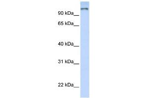 WB Suggested Anti-PAntibody Titration:  0. (PARP9 antibody  (N-Term))