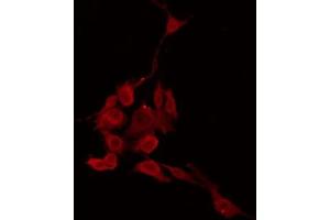 ABIN6274399 staining COLO205 by IF/ICC. (LDOC1L antibody)