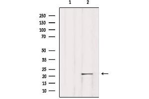 Western blot analysis of extracts from Rat lung, using TNFAIP8L1 Antibody.