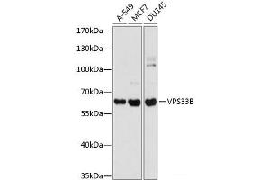 Western blot analysis of extracts of various cell lines using VPS33B Polyclonal Antibody at dilution of 1:1000. (VPS33B antibody)