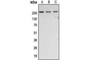 Western blot analysis of Fibronectin expression in HeLa (A), SP2/0 (B), rat lung (C) whole cell lysates.